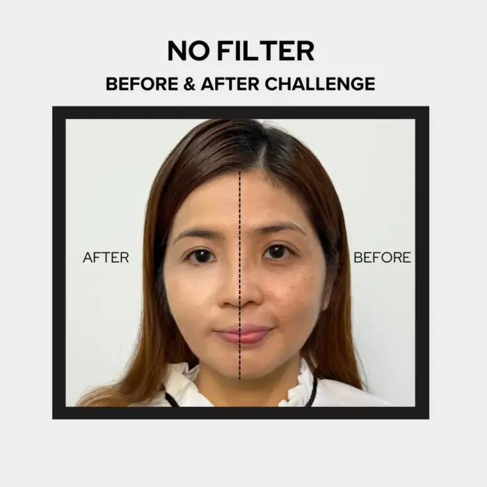 Before After 1 Before after 1