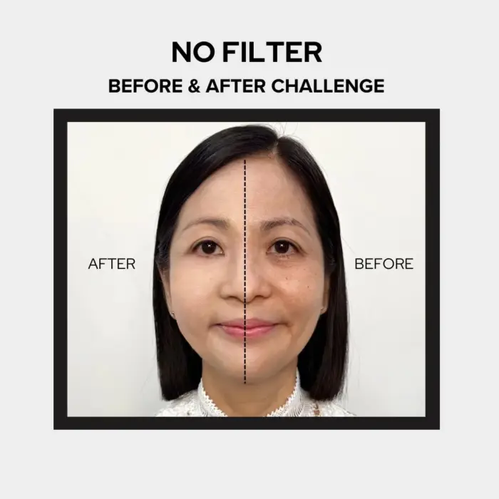 Before After 2 Before after 2
